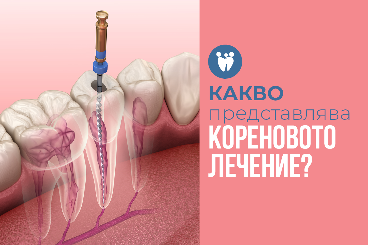Какво представлява кореновото лечение?