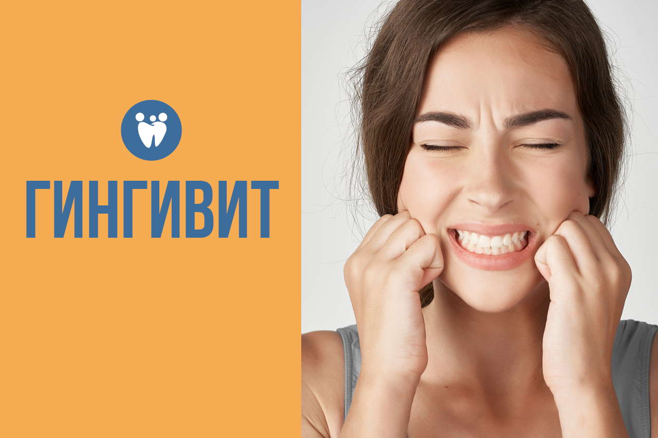 Гингивит