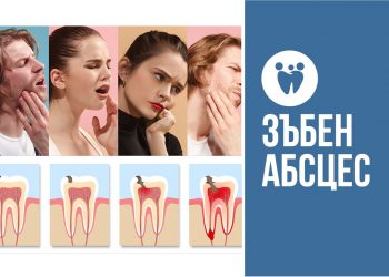 Зъбен абсцес
