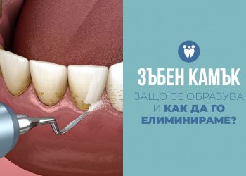 Зъбен камък – защо се образува и как да го елиминираме?