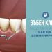 Зъбен камък – защо се образува и как да го елиминираме?
