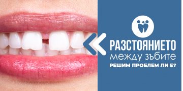 Разстояние между зъбите – решим проблем ли е?