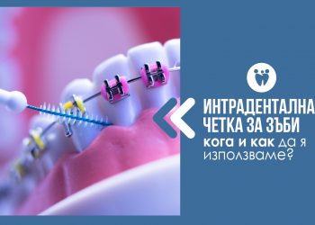 ИНТЕРДЕНТАЛНА ЧЕТКА ЗА ЗЪБИ – КОГА И КАК ДА Я ИЗПОЛЗВАМЕ?