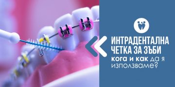 ИНТЕРДЕНТАЛНА ЧЕТКА ЗА ЗЪБИ – КОГА И КАК ДА Я ИЗПОЛЗВАМЕ?