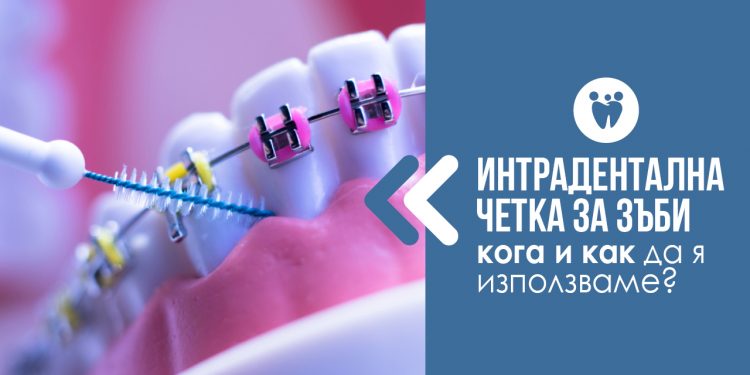 ИНТЕРДЕНТАЛНА ЧЕТКА ЗА ЗЪБИ – КОГА И КАК ДА Я ИЗПОЛЗВАМЕ?