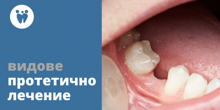 ВИДОВЕ ПРОТЕТИЧНО ЛЕЧЕНИЕ