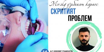 Междузъбният кариес – скритият проблем